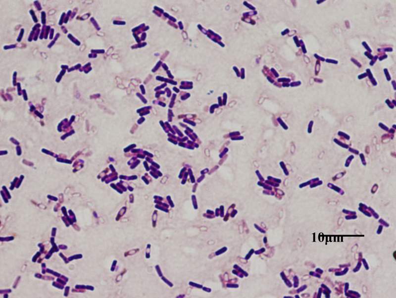八叠球菌显微镜图片